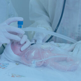 Infant T-Piece Resuscitator
