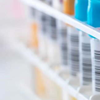 Auto Hematology Analyzer