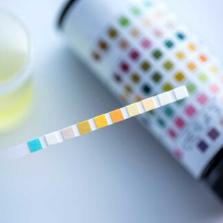 Urine Analyzer and Others